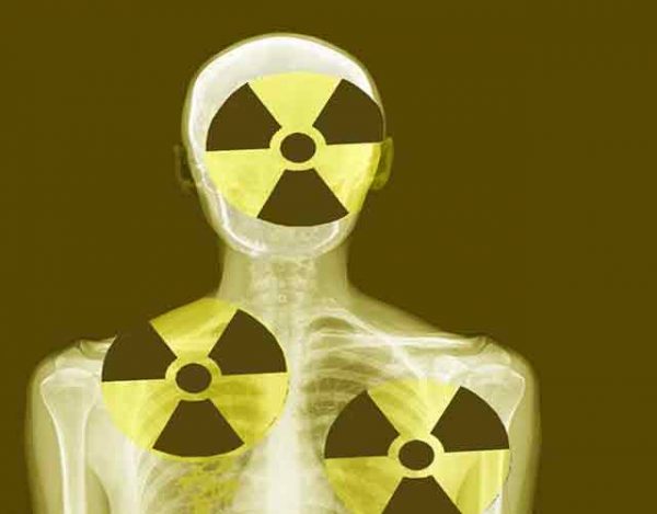 Efectos de la radiación