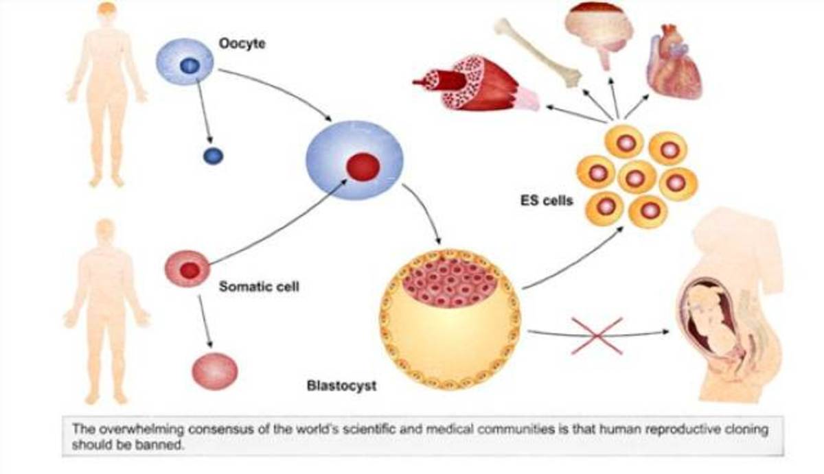 Репродуктивное клонирование. Терапевтическое клонирование схема. Терапевтическое клонирование человека. Терапевтическое клонирование человека картинки. Терапевтическое клонирование бластоциста.