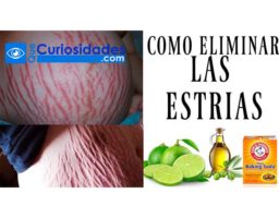 Como eliminar las estrías con limón, aceite de oliva y miel