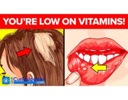 8 señales alarmantes de que a tu cuerpo le hacen falta más VITAMINAS