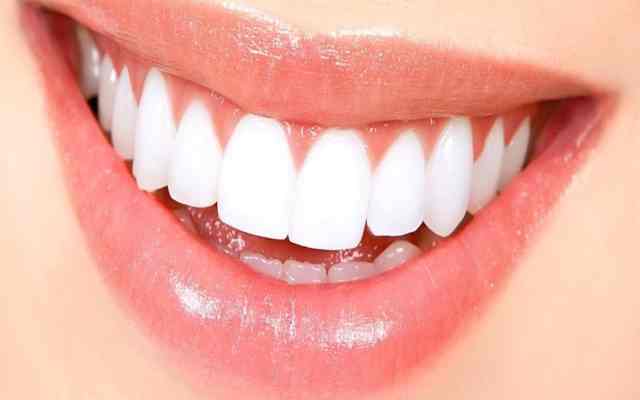 9 Trucos para tener dientes blancos y una sonrisa de Hollywood 