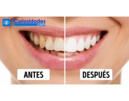 9 Trucos para tener dientes blancos y una sonrisa de Hollywood 