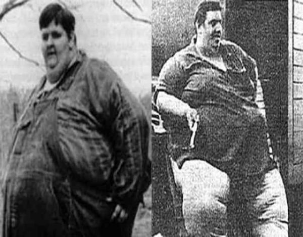 Esta era la persona más gorda del mundo