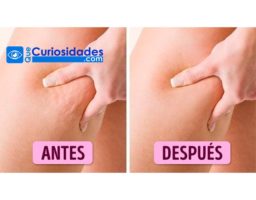 Plan para un mes que reducirá la celulitis en un 80%