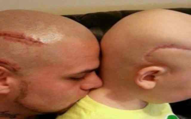 Se tatuó la cabeza en honor a su hijo con cáncer cerebral. 2 años después le toca dar un duro mensaje despedida.