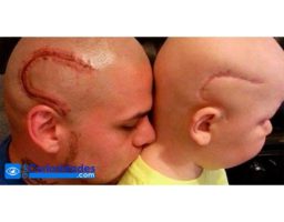 Se tatuó la cabeza en honor a su hijo con cáncer cerebral. 2 años después le toca dar un duro mensaje despedida.