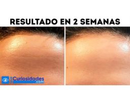 12 Personas que lograron conseguir que su cutis sea perfecto. Sus secretos pueden serte útiles