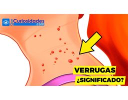 Este es el verdadero significado de las verrugas en el cuello