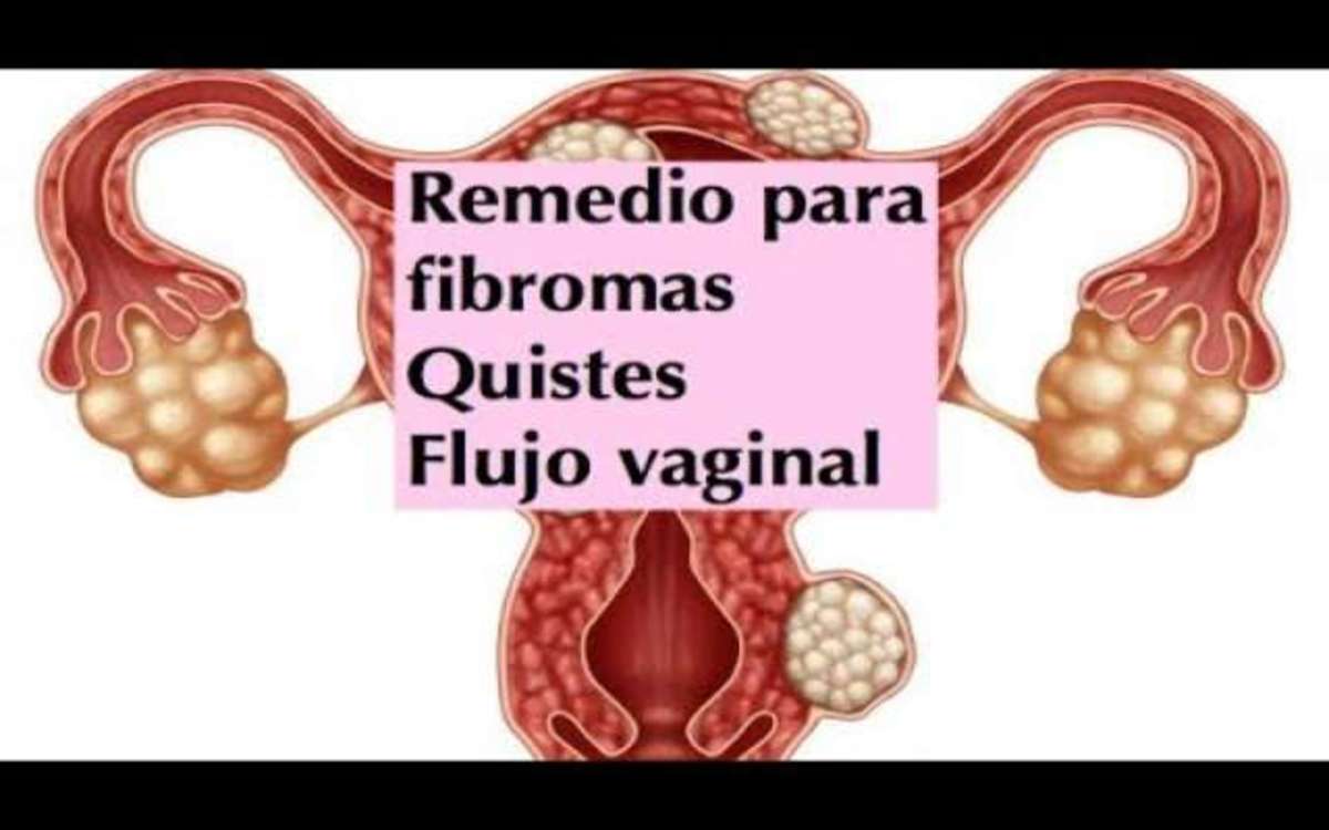 Como estimular los ovarios de forma natural