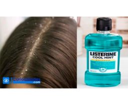 ¿Usar Listerine para la caspa? 3 métodos fáciles que te sorprenderán